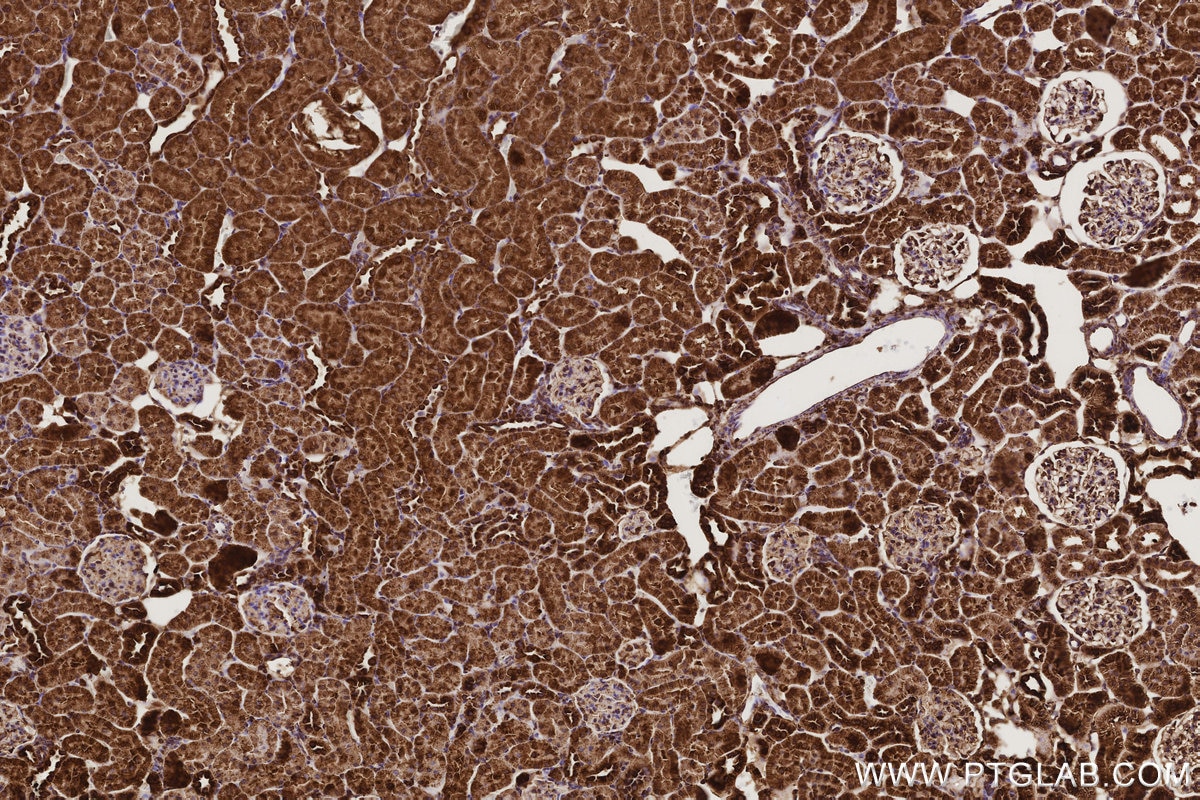 Immunohistochemical analysis of paraffin-embedded rat kidney tissue slide using KHC3169 (Ribophorin I IHC Kit).