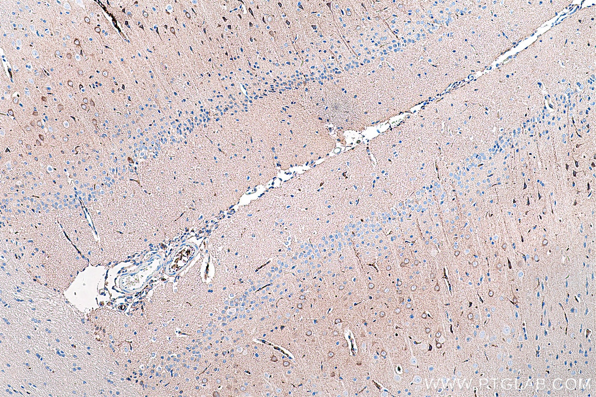 Immunohistochemical analysis of paraffin-embedded rat brain tissue slide using KHC0248 (S100A1 IHC Kit).