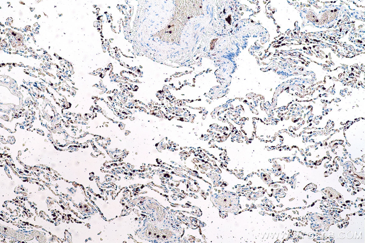 Immunohistochemical analysis of paraffin-embedded human lung tissue slide using KHC0581 (S100A12 IHC Kit).