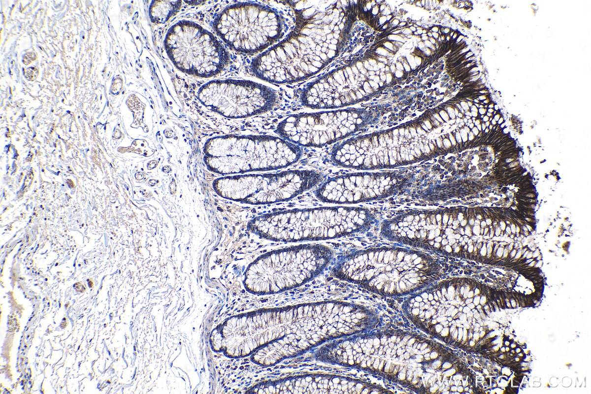 Immunohistochemical analysis of paraffin-embedded human colon tissue slide using KHC1192 (S100A14 IHC Kit).