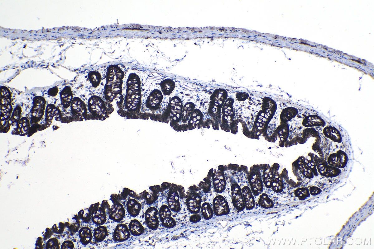 Immunohistochemical analysis of paraffin-embedded rat colon tissue slide using KHC1192 (S100A14 IHC Kit).