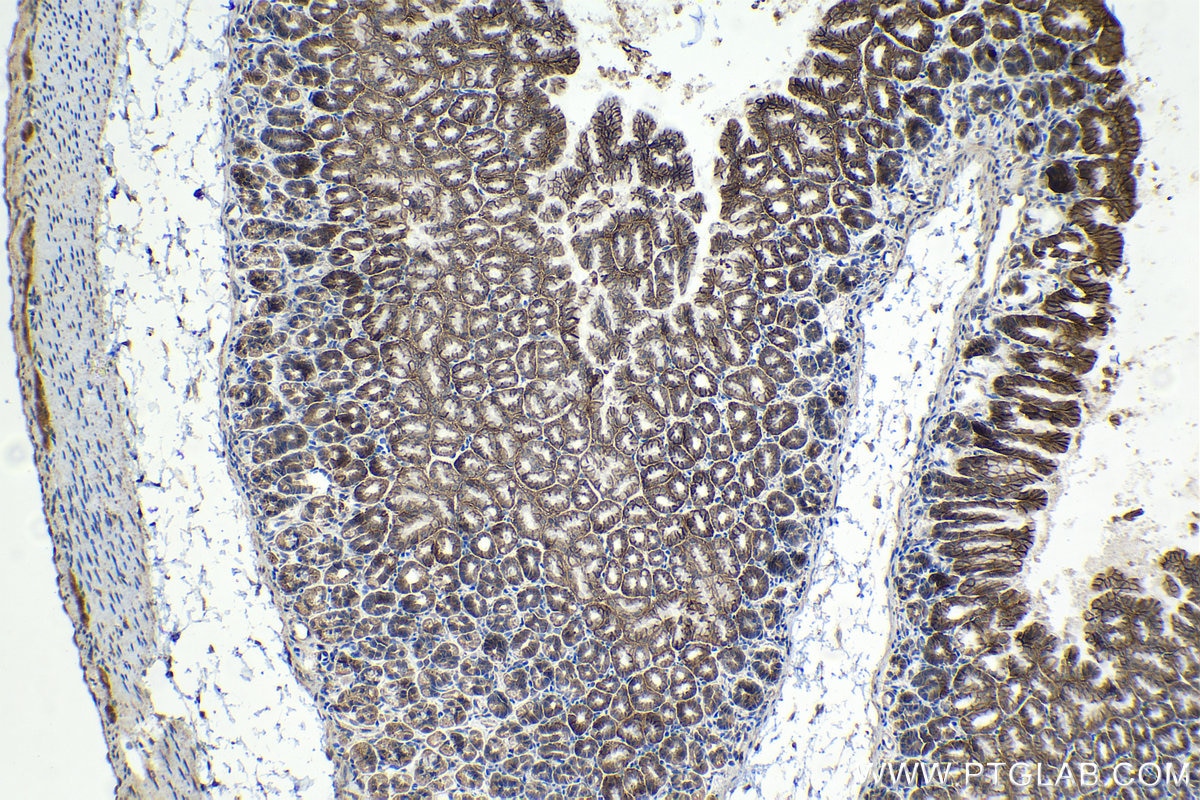 Immunohistochemical analysis of paraffin-embedded mouse stomach tissue slide using KHC1192 (S100A14 IHC Kit).