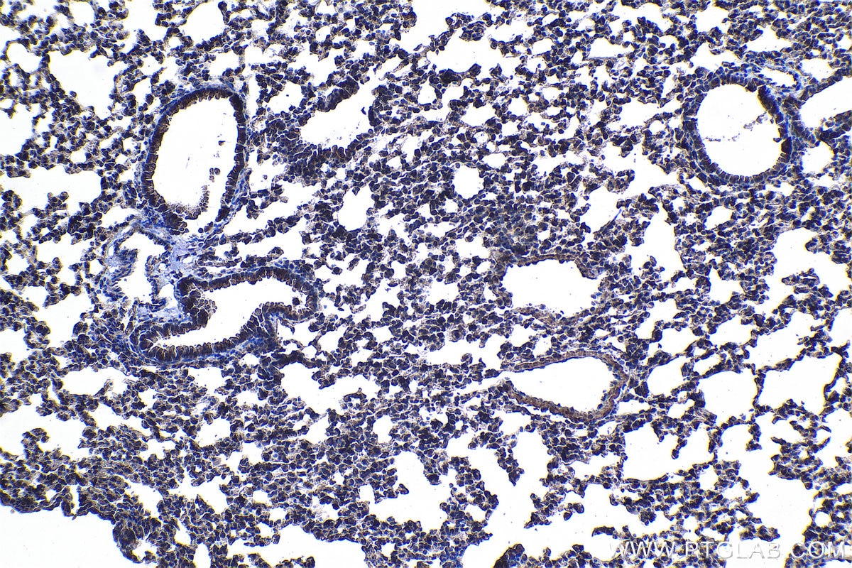 Immunohistochemical analysis of paraffin-embedded mouse lung tissue slide using KHC1166 (S100A9 IHC Kit).