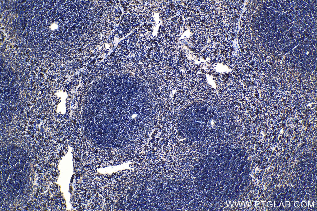 Immunohistochemical analysis of paraffin-embedded mouse spleen tissue slide using KHC1166 (S100A9 IHC Kit).