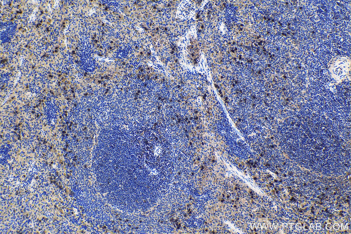 Immunohistochemical analysis of paraffin-embedded rat spleen tissue slide using KHC1166 (S100A9 IHC Kit).