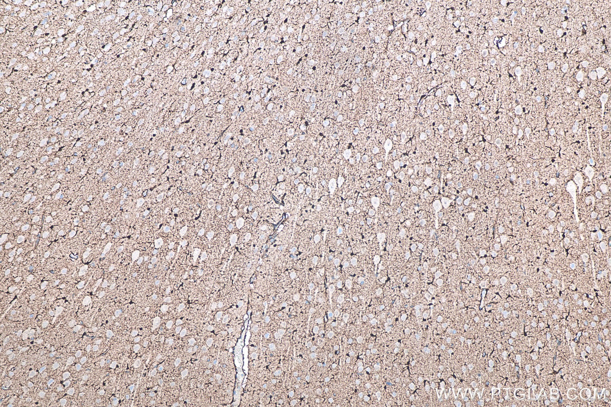 Immunohistochemical analysis of paraffin-embedded rat brain tissue slide using KHC0050 (S100B IHC Kit).