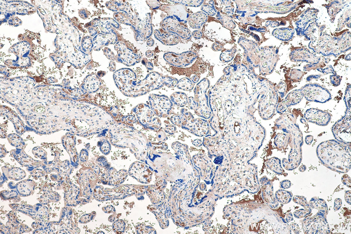 Immunohistochemical analysis of paraffin-embedded human placenta tissue slide using KHC0456 (SAA4 IHC Kit).