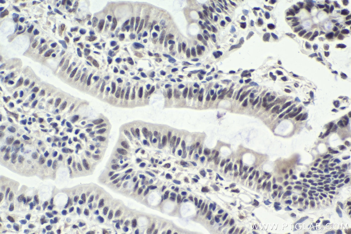 Immunohistochemical analysis of paraffin-embedded rat small intestine tissue slide using KHC1752 (SAFB IHC Kit).