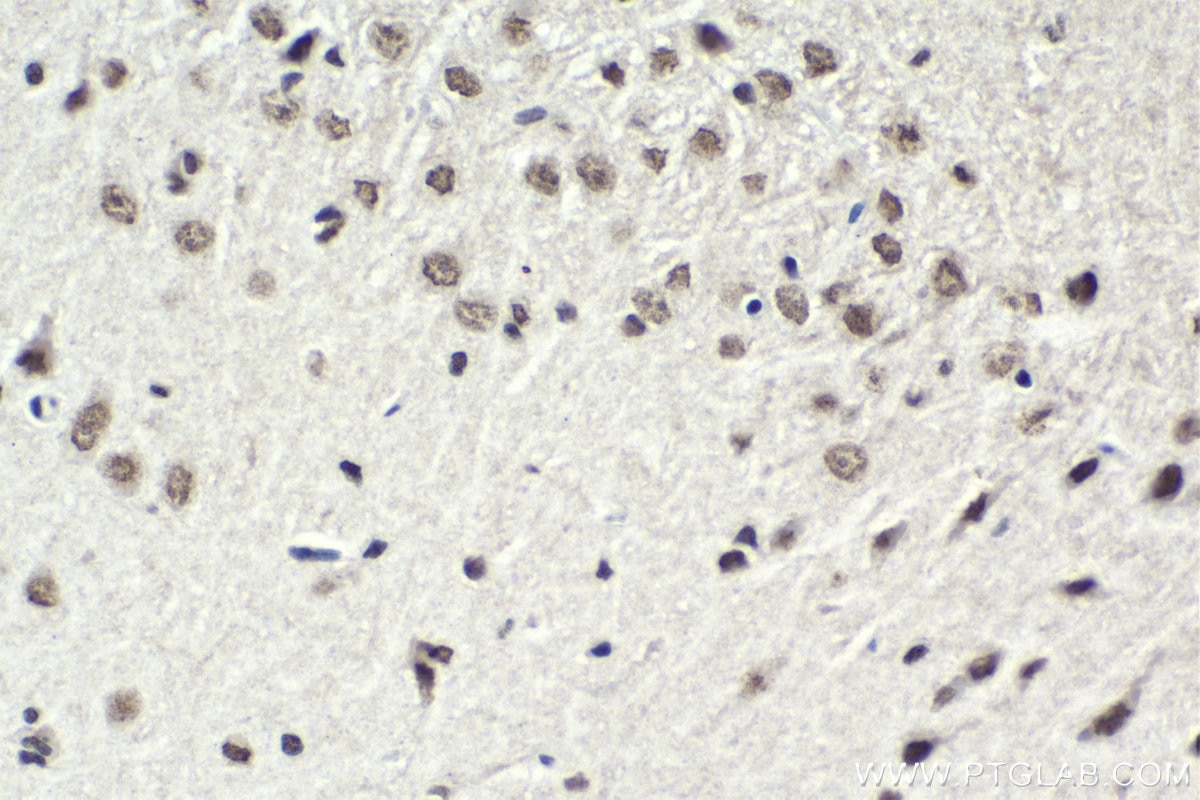 Immunohistochemical analysis of paraffin-embedded rat brain tissue slide using KHC1752 (SAFB IHC Kit).