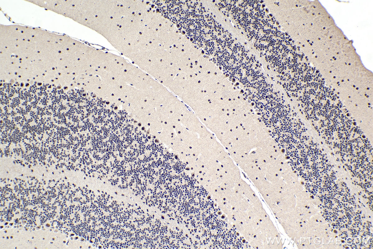 Immunohistochemical analysis of paraffin-embedded mouse cerebellum tissue slide using KHC1725 (SAFB2 IHC Kit).