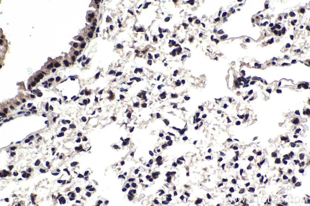 Immunohistochemical analysis of paraffin-embedded mouse lung tissue slide using KHC1725 (SAFB2 IHC Kit).