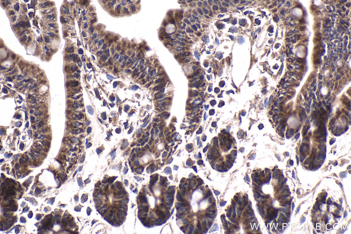Immunohistochemical analysis of paraffin-embedded mouse small intestine tissue slide using KHC1776 (SAMD4B IHC Kit).