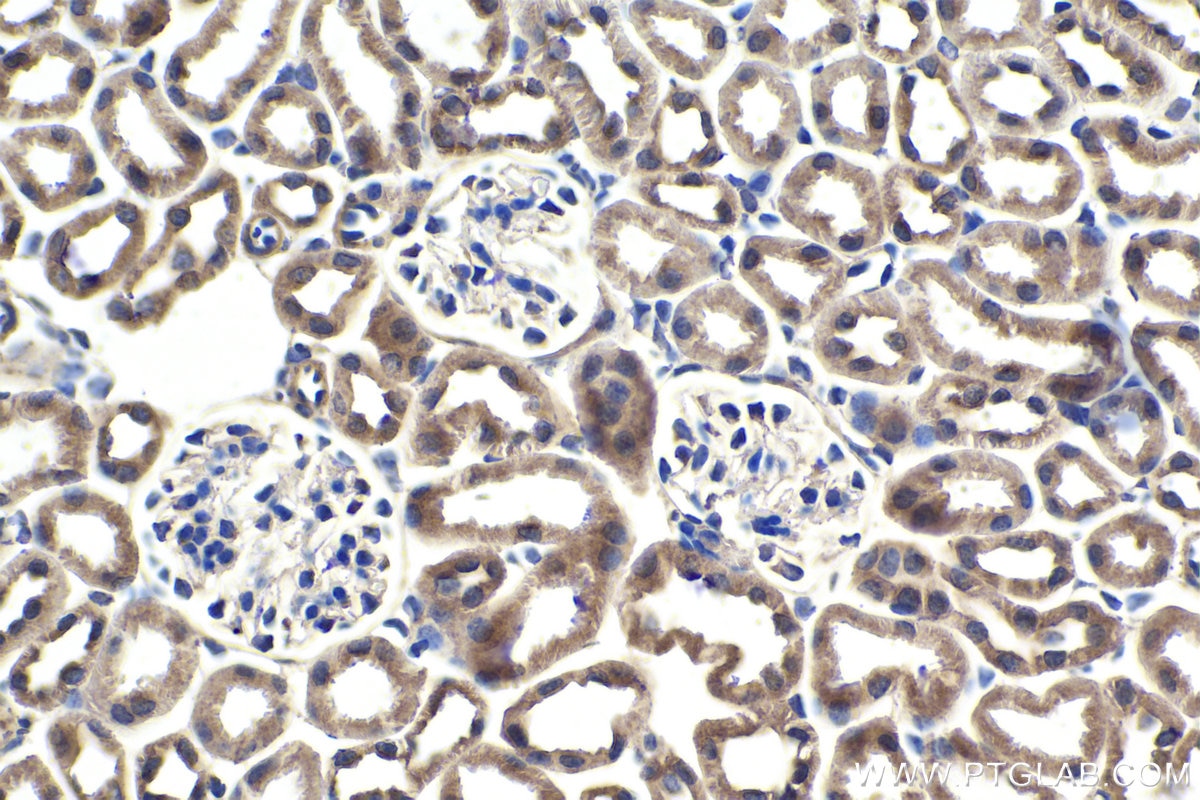 Immunohistochemical analysis of paraffin-embedded mouse kidney tissue slide using KHC1776 (SAMD4B IHC Kit).