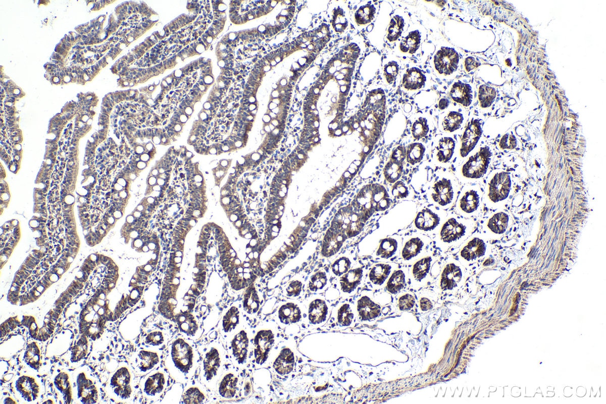 Immunohistochemical analysis of paraffin-embedded rat small intestine tissue slide using KHC1776 (SAMD4B IHC Kit).