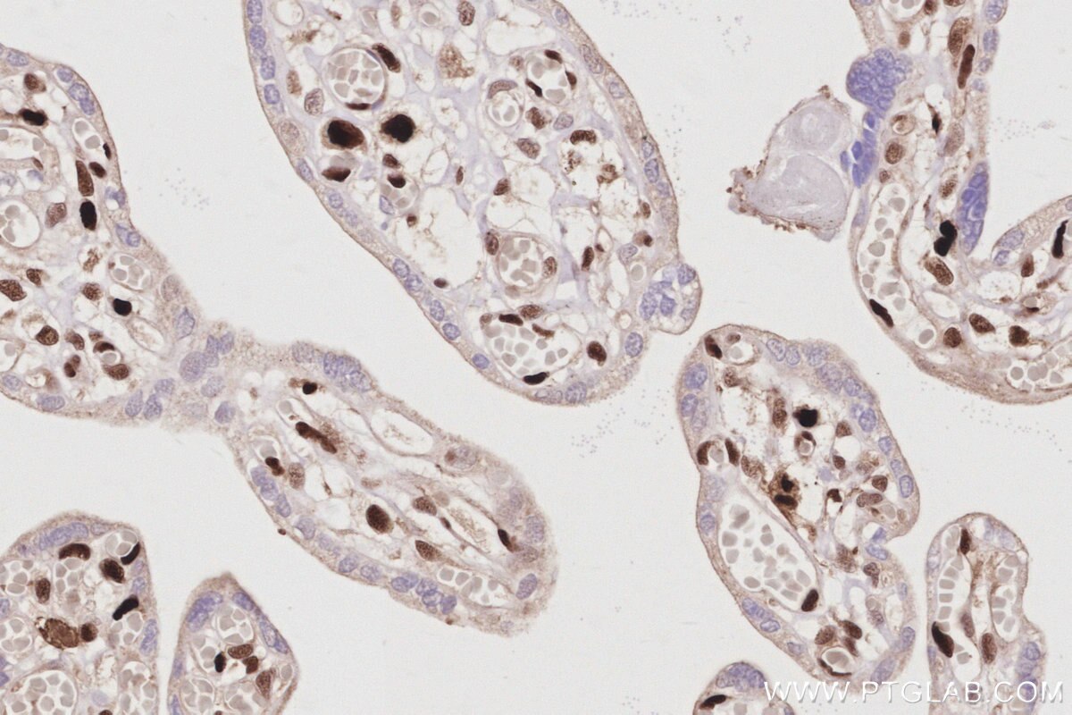 Immunohistochemical analysis of paraffin-embedded human placenta tissue slide using KHC3068 (SAMHD1 IHC Kit). Immunohistochemical analysis of paraffin-embedded human placenta tissue slide using KHC3068 (SAMHD1 IHC Kit).