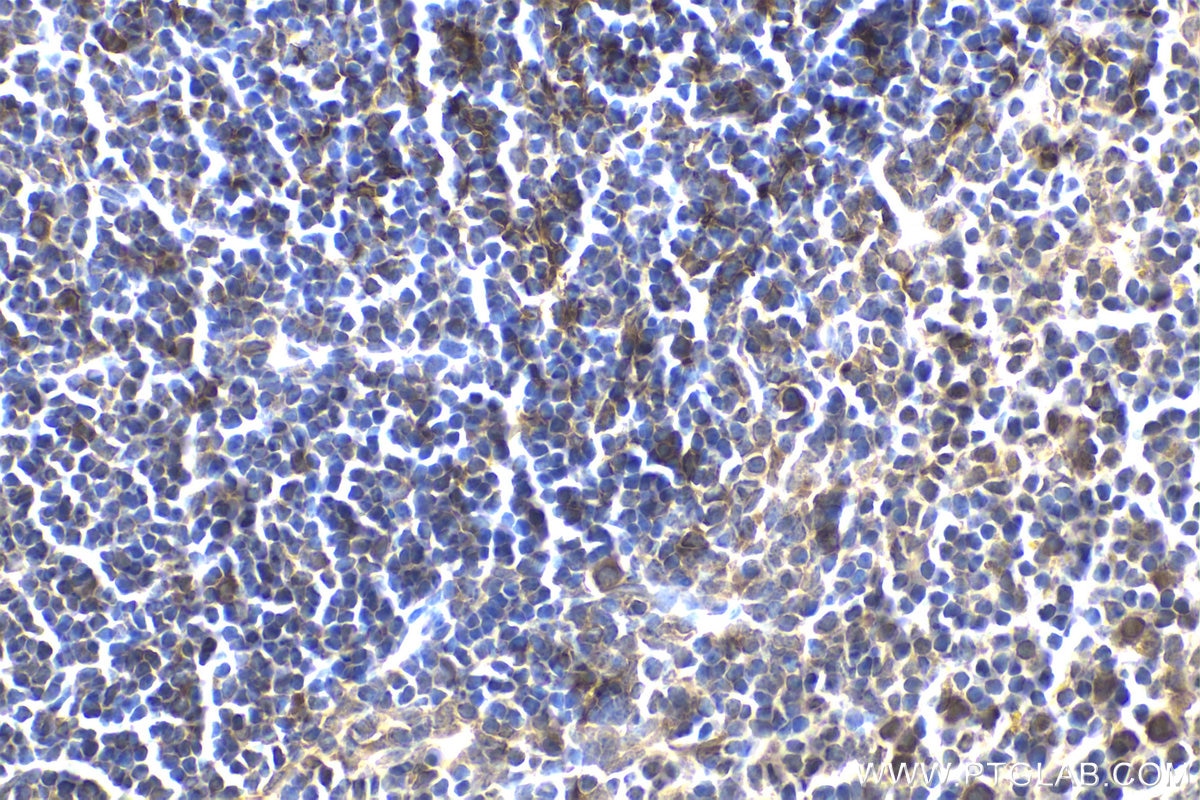 Immunohistochemical analysis of paraffin-embedded mouse spleen tissue slide using KHC1965 (SAMSN1 IHC Kit).