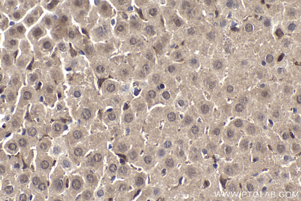 Immunohistochemical analysis of paraffin-embedded mouse liver tissue slide using KHC1965 (SAMSN1 IHC Kit).