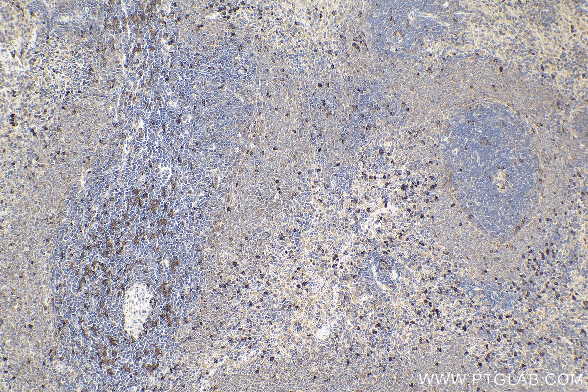 Immunohistochemical analysis of paraffin-embedded rat spleen tissue slide using KHC1965 (SAMSN1 IHC Kit).