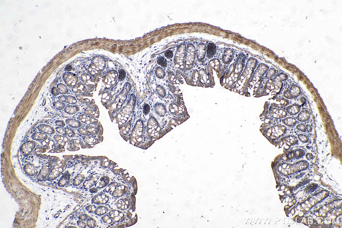 Immunohistochemical analysis of paraffin-embedded mouse colon tissue slide using KHC0705 (SAR1A IHC Kit).