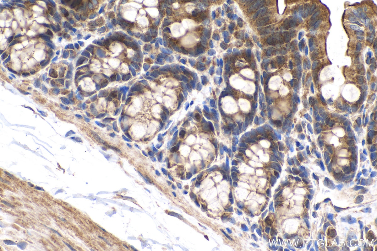 Immunohistochemical analysis of paraffin-embedded rat colon tissue slide using KHC0705 (SAR1A IHC Kit).