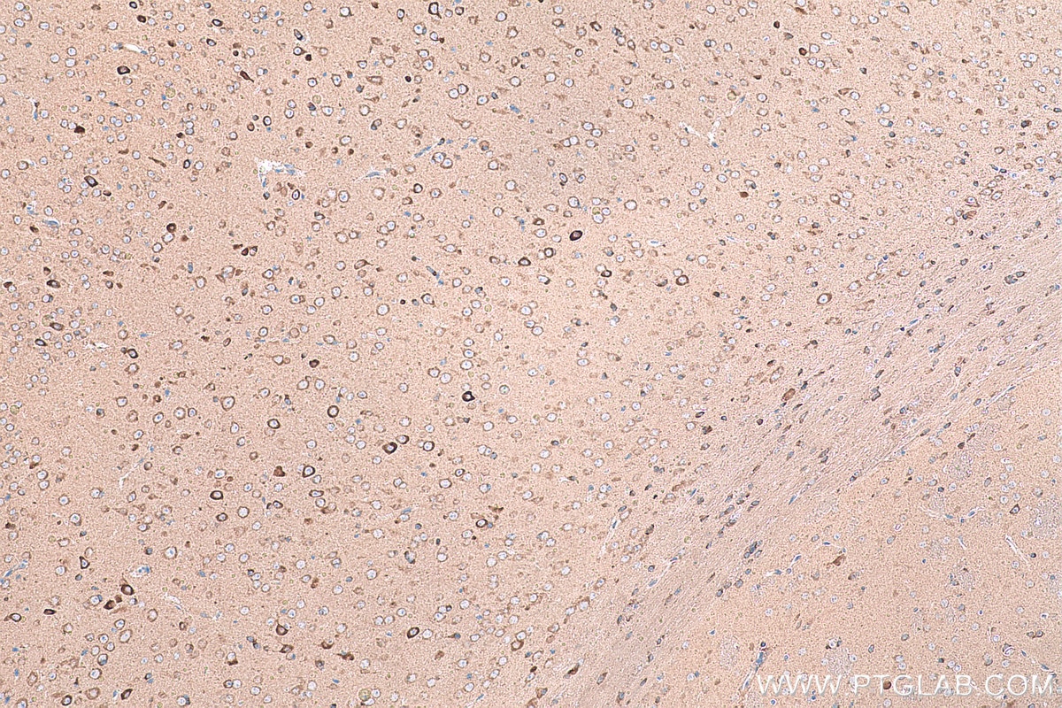 Immunohistochemical analysis of paraffin-embedded mouse brain tissue slide using KHC0952 (SARS IHC Kit).