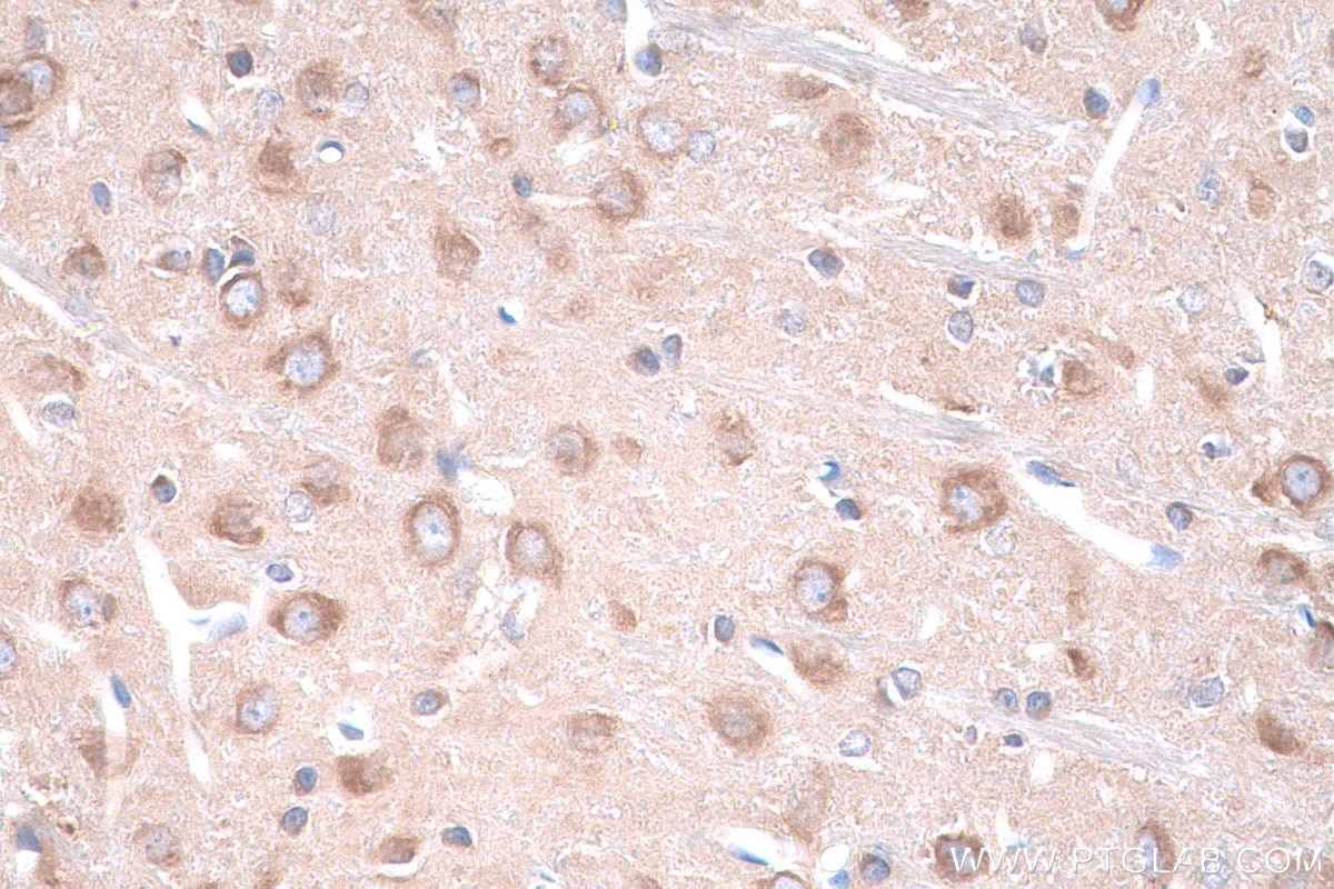 Immunohistochemical analysis of paraffin-embedded rat brain tissue slide using KHC0952 (SARS IHC Kit).