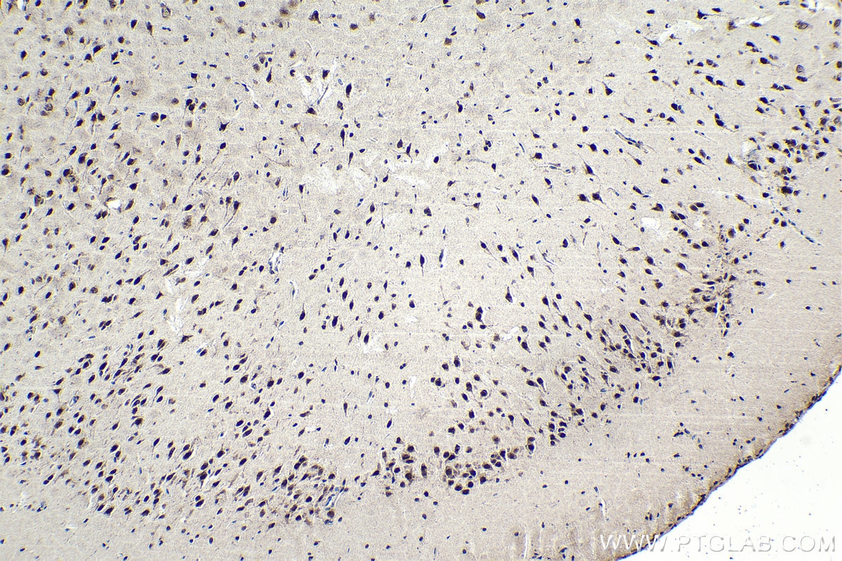 Immunohistochemical analysis of paraffin-embedded rat brain tissue slide using KHC1746 (SART3 IHC Kit).