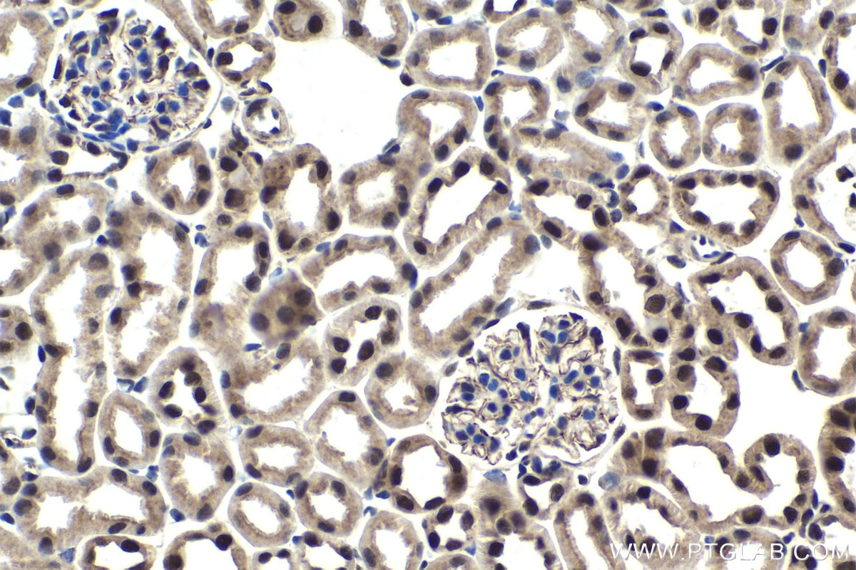 Immunohistochemical analysis of paraffin-embedded mouse kidney tissue slide using KHC1746 (SART3 IHC Kit).