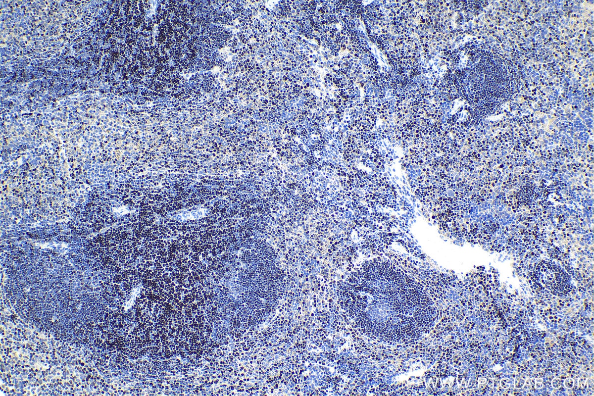 Immunohistochemical analysis of paraffin-embedded mouse spleen tissue slide using KHC1666 (SATB1 IHC Kit).