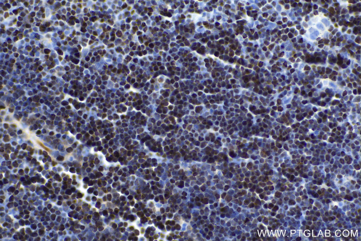 Immunohistochemical analysis of paraffin-embedded mouse thymus tissue slide using KHC1666 (SATB1 IHC Kit).