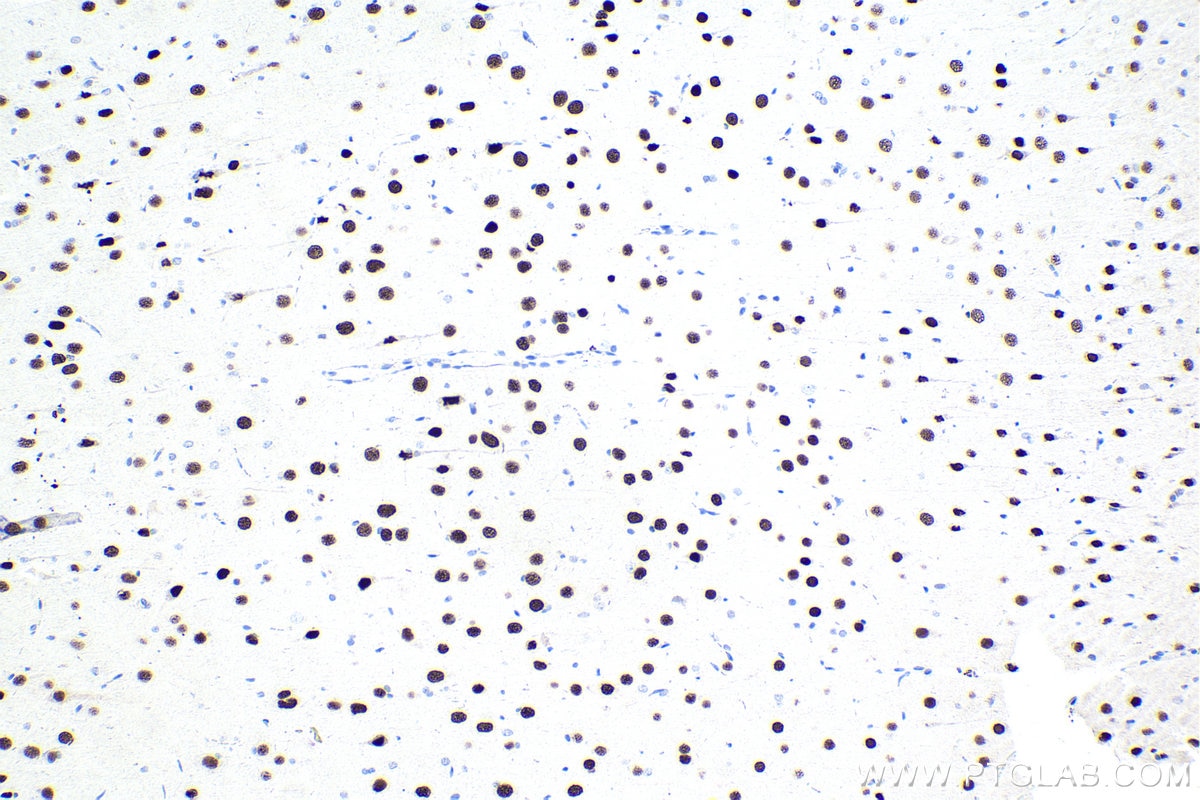 Immunohistochemical analysis of paraffin-embedded rat brain tissue slide using KHC1666 (SATB1 IHC Kit).