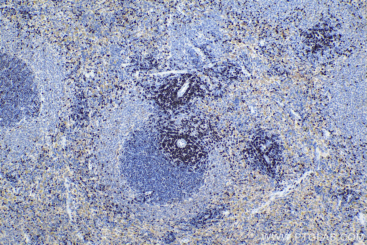 Immunohistochemical analysis of paraffin-embedded rat spleen tissue slide using KHC1666 (SATB1 IHC Kit).