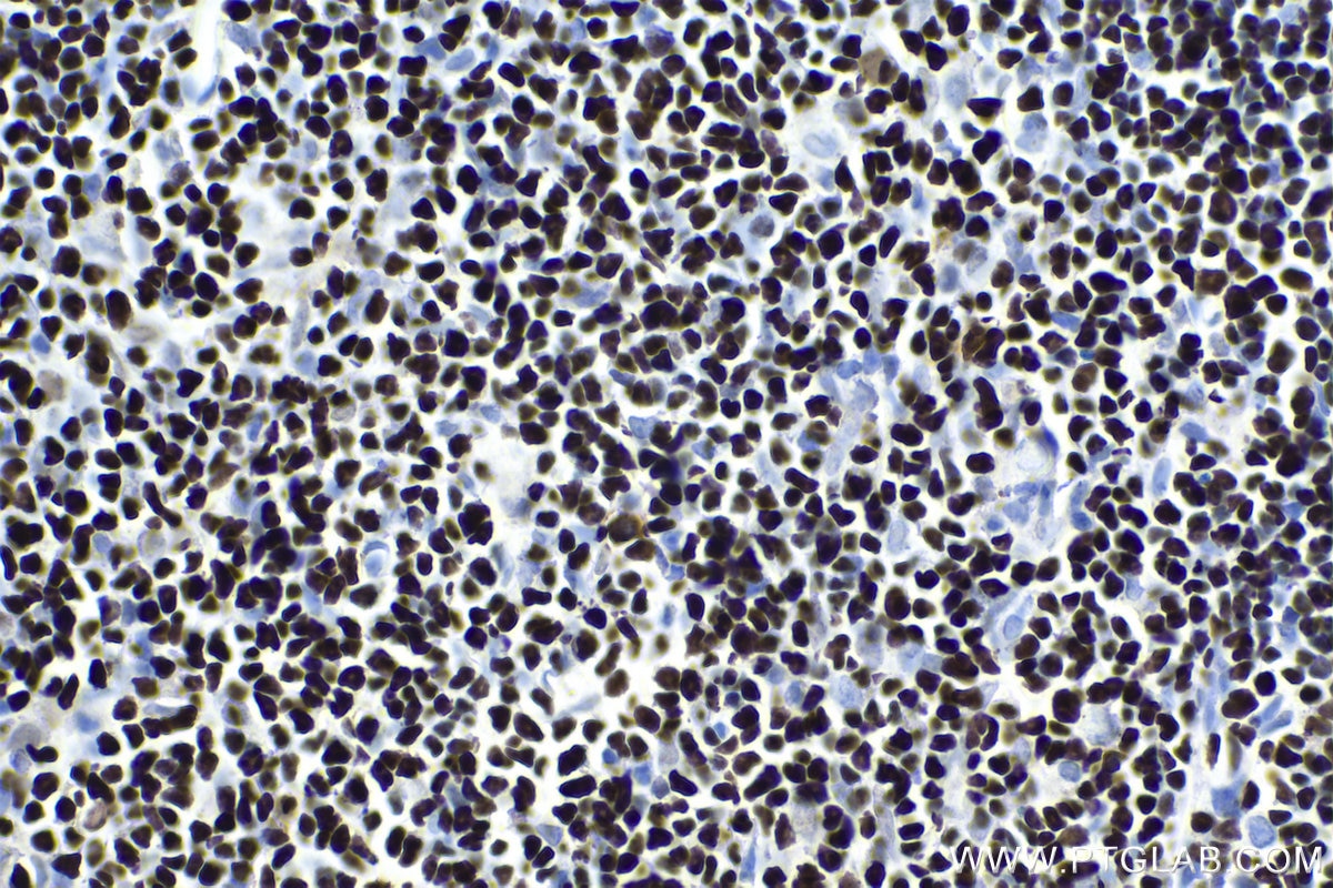 Immunohistochemical analysis of paraffin-embedded rat thymus tissue slide using KHC1666 (SATB1 IHC Kit).