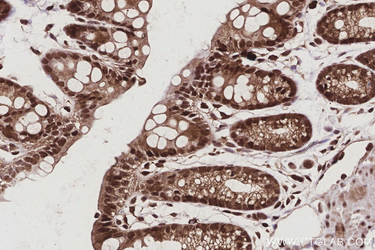 Immunohistochemical analysis of paraffin-embedded mouse colon tissue slide using KHC3060 (SBDS IHC Kit). Immunohistochemical analysis of paraffin-embedded mouse colon tissue slide using KHC3060 (SBDS IHC Kit).