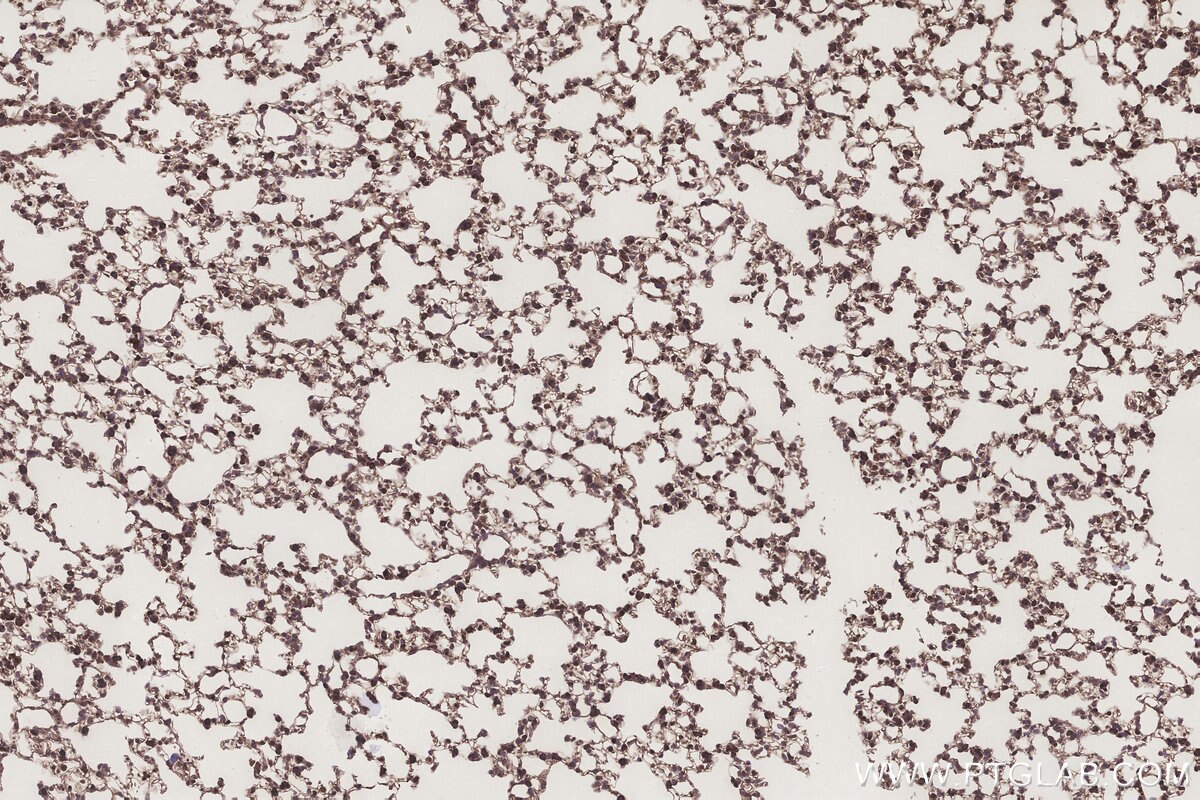 Immunohistochemical analysis of paraffin-embedded mouse lung tissue slide using KHC3198 (SCP2/SCPx IHC Kit).