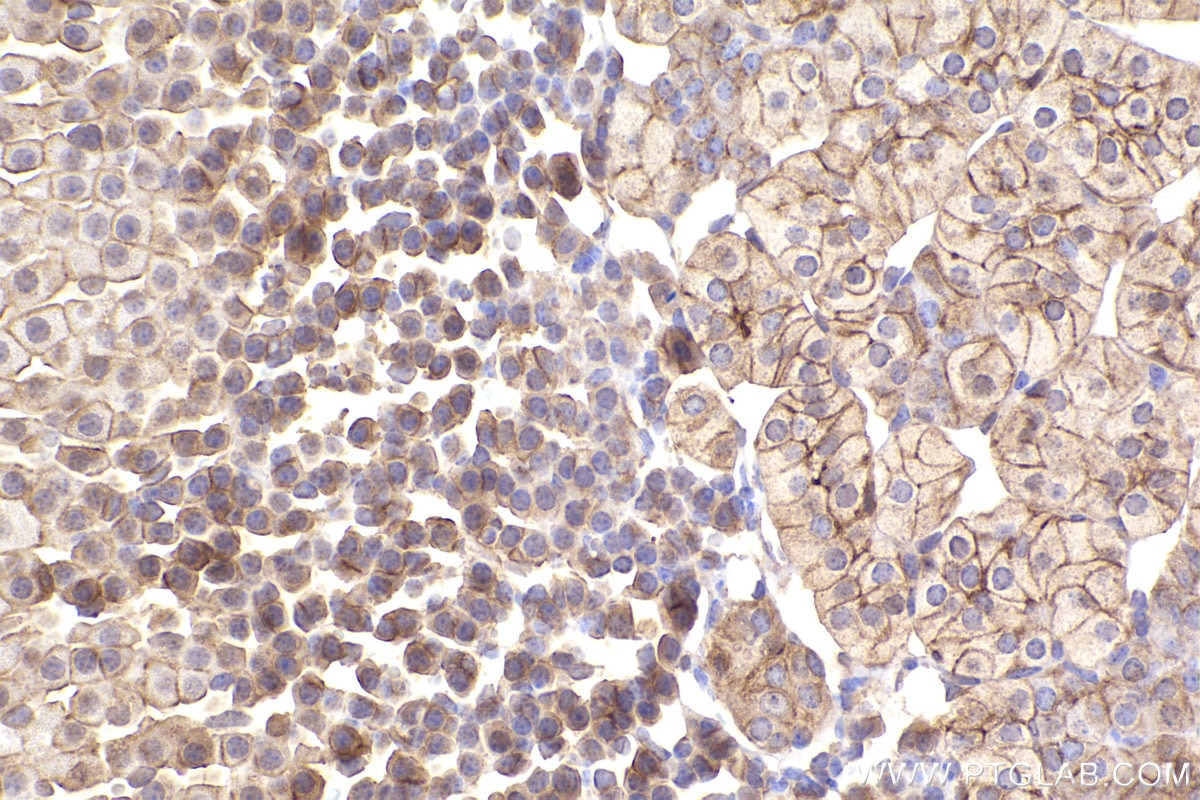 Immunohistochemical analysis of paraffin-embedded mouse adrenal gland tissue slide using KHC2450 (SCRIB IHC Kit).