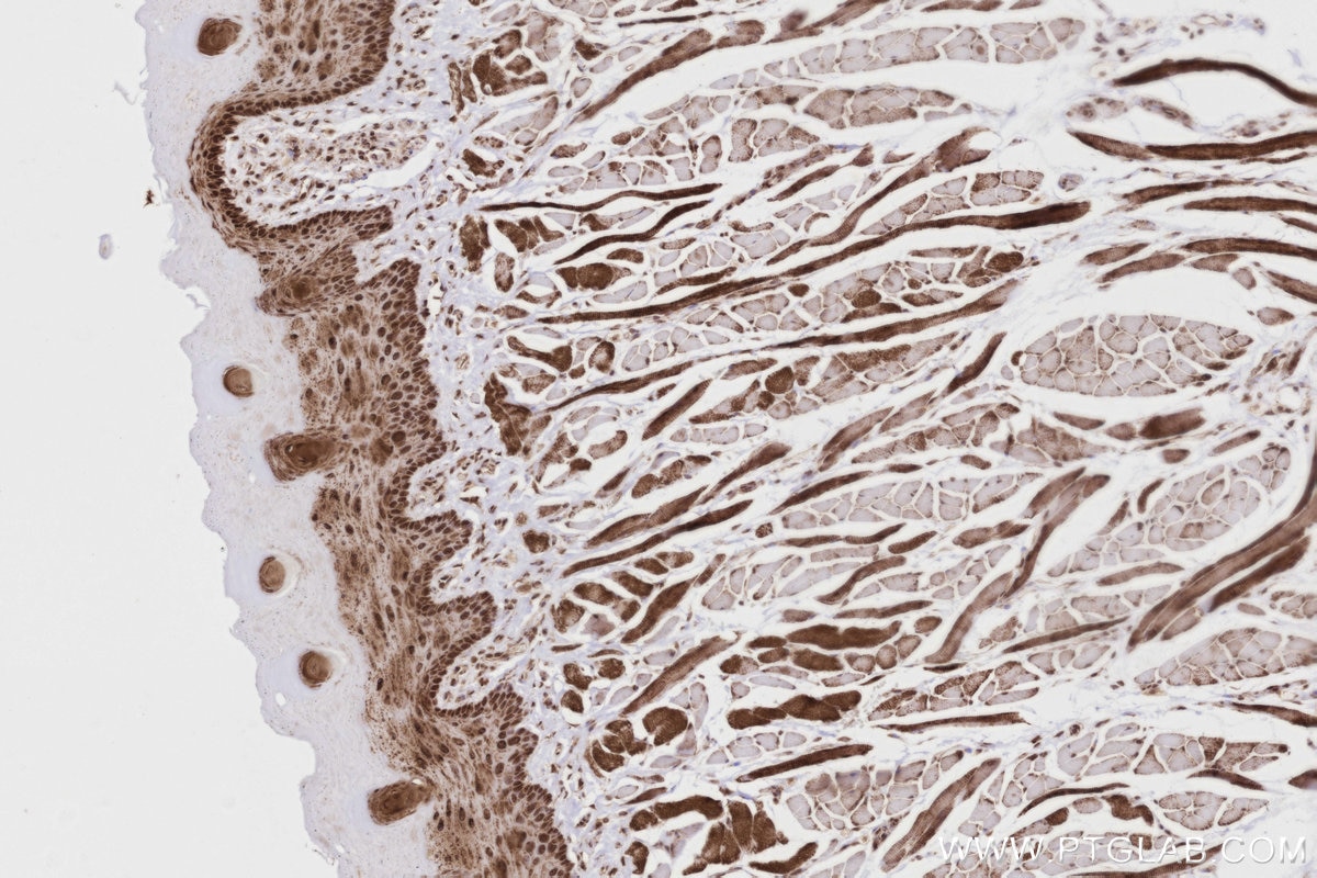 Immunohistochemical analysis of paraffin-embedded rat tongue tissue slide using KHC2803 (SCYL1 IHC Kit).