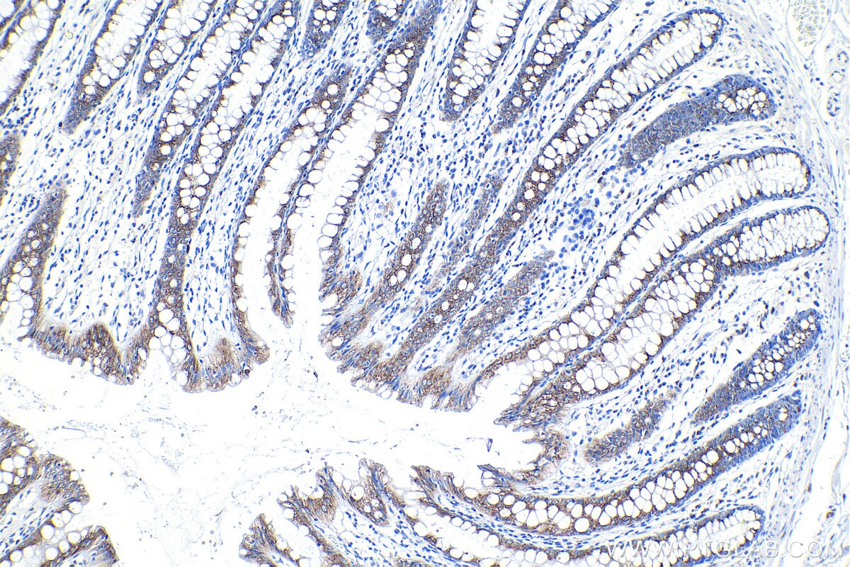 Immunohistochemical analysis of paraffin-embedded human colon tissue slide using KHC1250 (SDF4 IHC Kit).