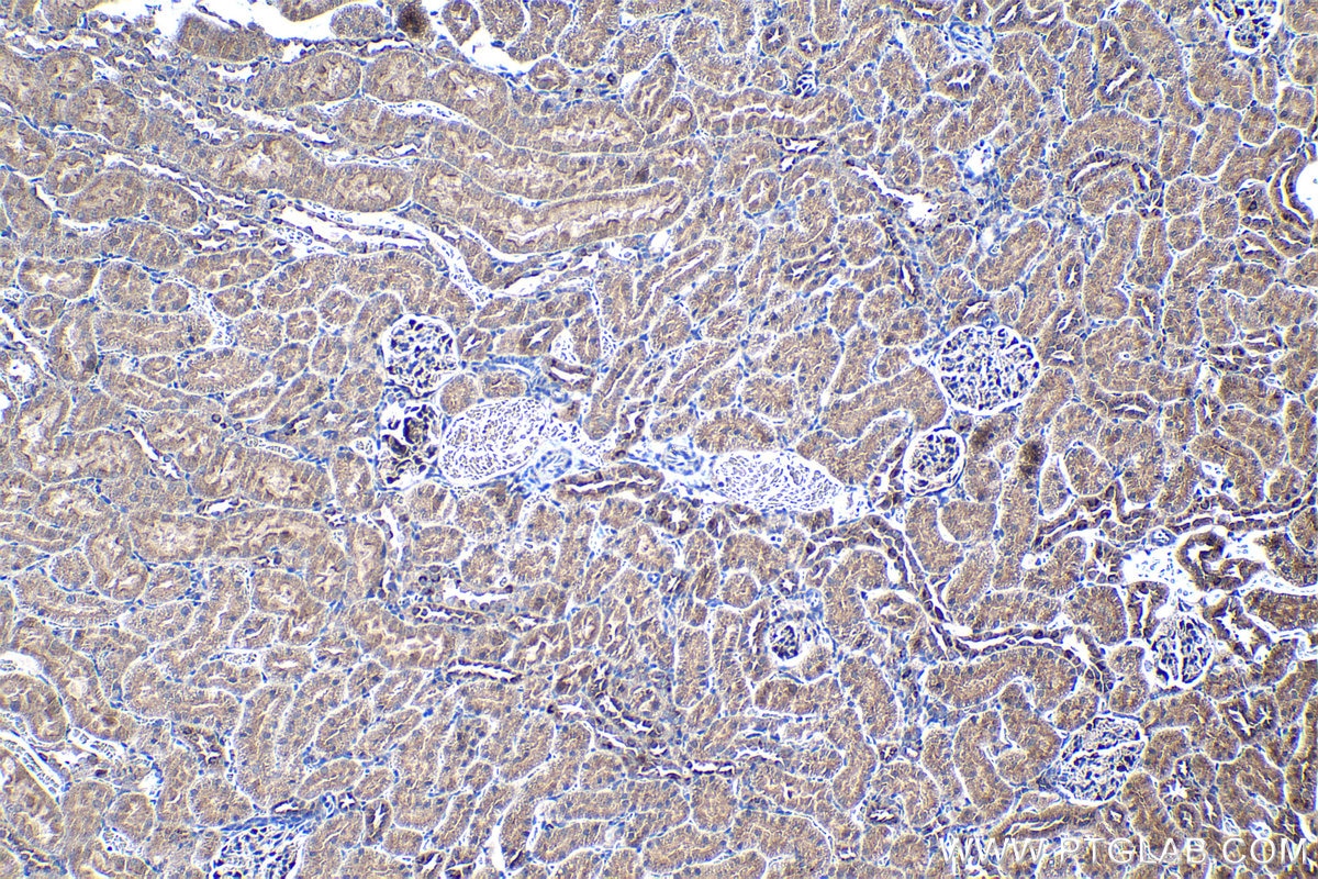 Immunohistochemical analysis of paraffin-embedded rat kidney tissue slide using KHC1250 (SDF4 IHC Kit).