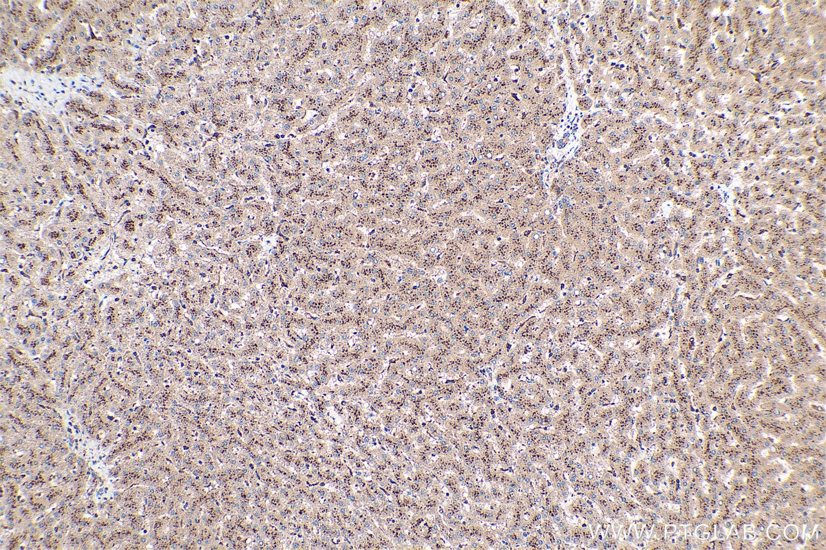 Immunohistochemical analysis of paraffin-embedded human liver tissue slide using KHC0457 (SDSL IHC Kit).