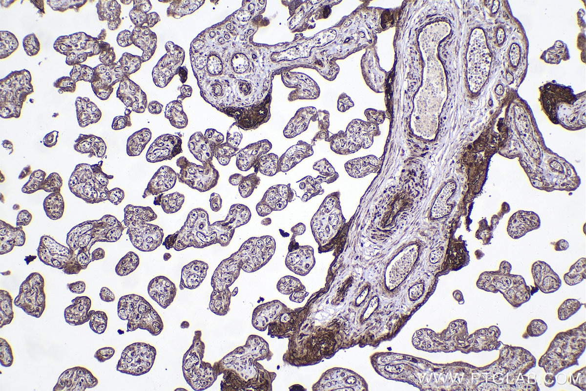 Immunohistochemical analysis of paraffin-embedded human placenta tissue slide using KHC2066 (SEC16A IHC Kit).