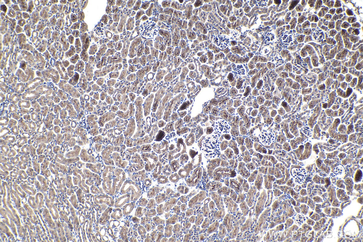 Immunohistochemical analysis of paraffin-embedded mouse kidney tissue slide using KHC0994 (SEC24C IHC Kit).