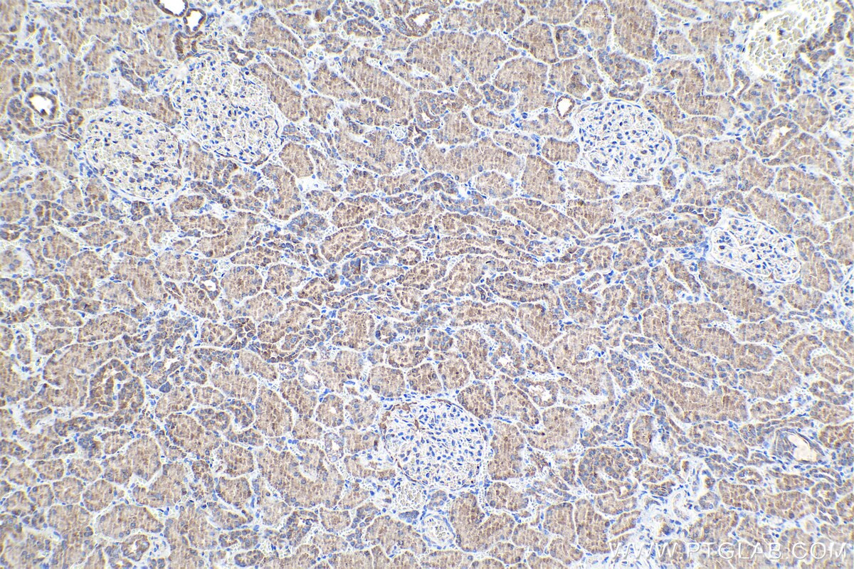 Immunohistochemical analysis of paraffin-embedded human kidney tissue slide using KHC0994 (SEC24C IHC Kit).