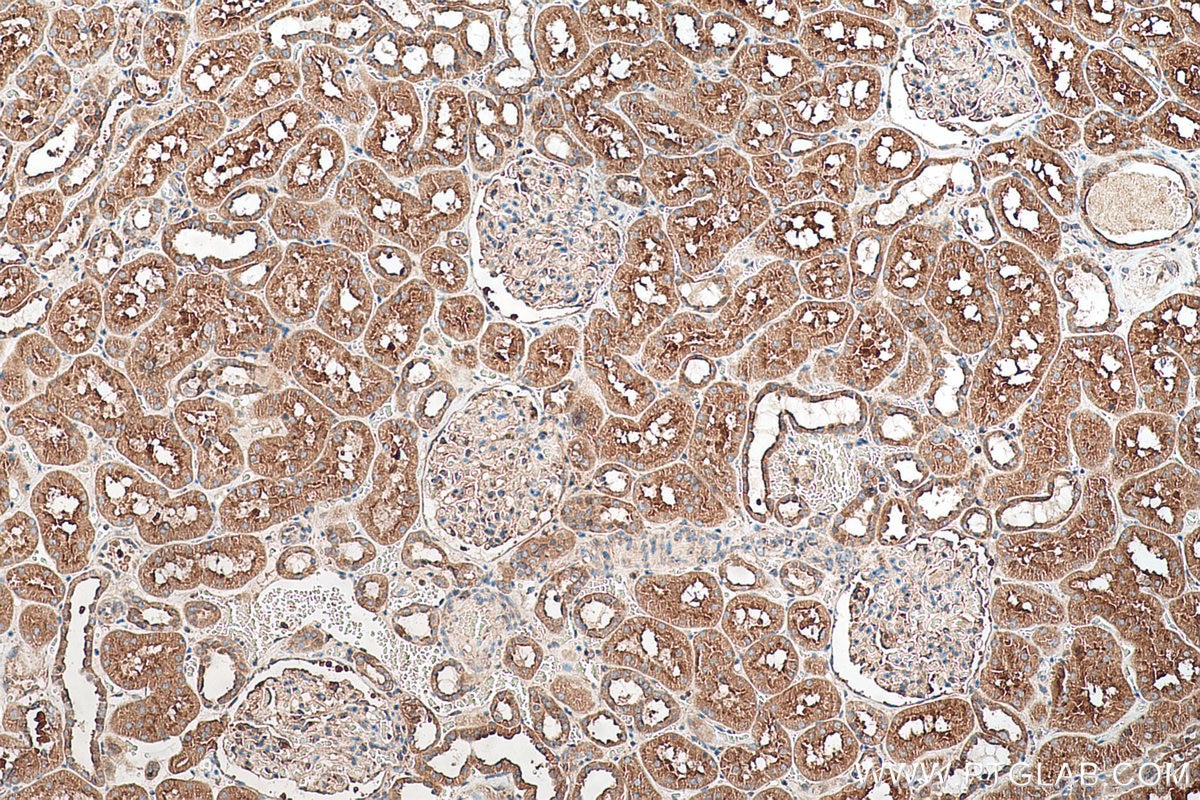 Immunohistochemical analysis of paraffin-embedded human kidney tissue slide using KHC0703 (SEC31A IHC Kit).