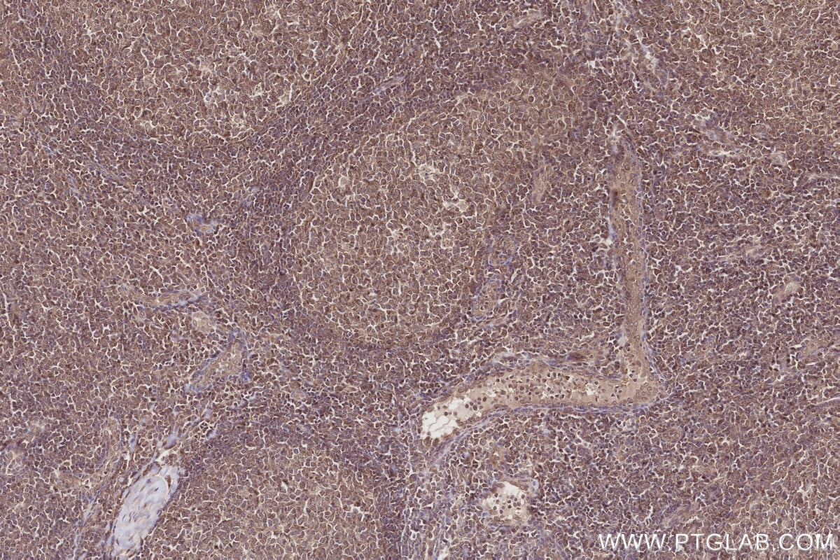 Immunohistochemical analysis of paraffin-embedded human tonsillitis tissue slide using KHC2789 (SEH1L IHC Kit).