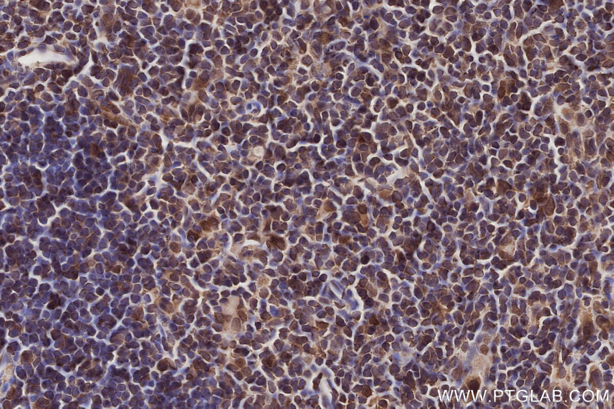Immunohistochemical analysis of paraffin-embedded mouse thymus tissue slide using KHC2789 (SEH1L IHC Kit).