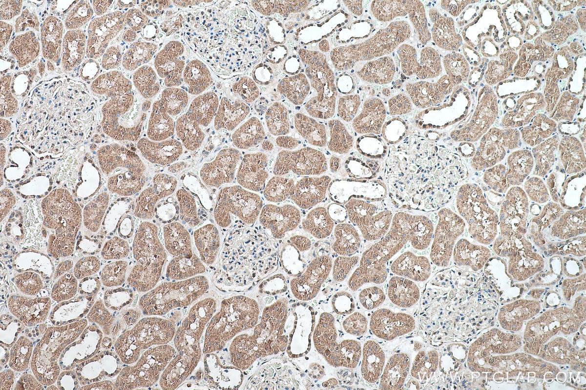 Immunohistochemical analysis of paraffin-embedded human kidney tissue slide using KHC0574 (SELENBP1 IHC Kit).
