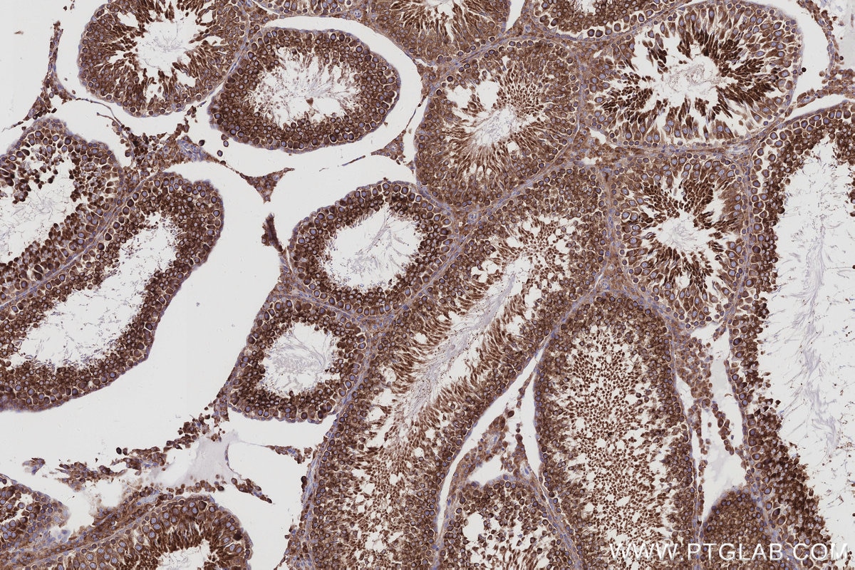 Immunohistochemical analysis of paraffin-embedded rat testis tissue slide using KHC2985 (SENP1 IHC Kit).