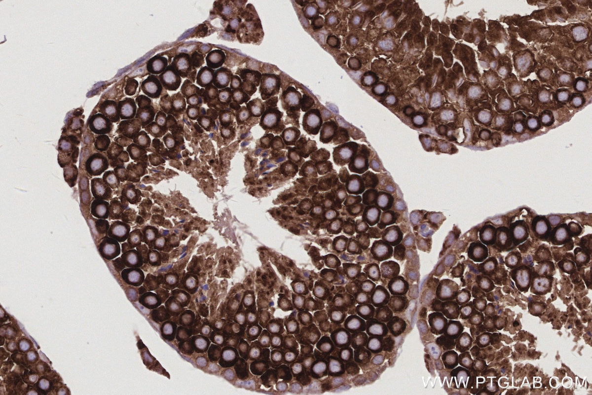 Immunohistochemical analysis of paraffin-embedded mouse testis tissue slide using KHC2985 (SENP1 IHC Kit).
