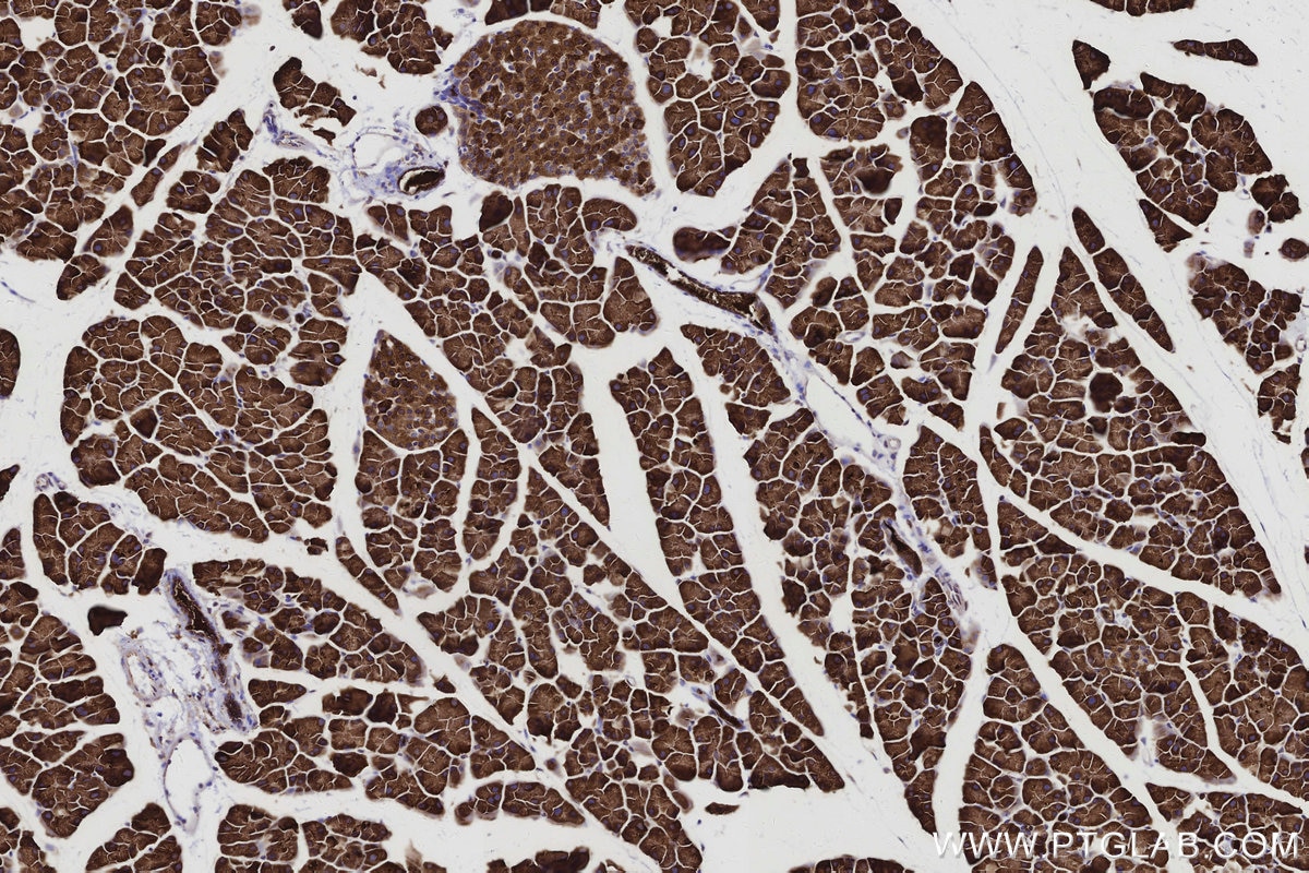 Immunohistochemical analysis of paraffin-embedded mouse pancreas tissue slide using KHC2985 (SENP1 IHC Kit).